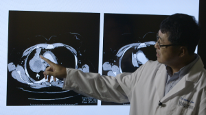Dr Chen examines scans of cancer in the body before and after immunotherapy treatment 